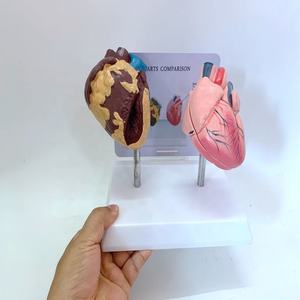 Modelo de Patología del Corazón Humano para Ciencias Médicas, Modelo de Enfermedades Orgánicas, Modelo Antidrogas - Product Image 4