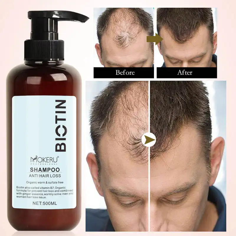 Commercio all'ingrosso MOKERU buon Feedback Set Anti-perdita di capelli Shampoo balsamo e olio essenziale trattamento per la caduta dei capelli