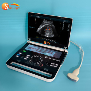 Offre Spéciale : Échographe <span class=keywords><strong>Doppler</strong></span> Couleur 3D/4D Portable – Appareil d'Échographie Hospitalière - Product Image 2