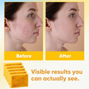 Savon exfoliant au curcuma et au miel pour le visage et le corps, lissant, éclaircissant et unifiant le teint - Product Image 3