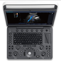 Sonoscape E2V diagnostic précis et efficace calcul automatique échographie vétérinaire doppler couleur haute résolution