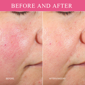 Donne Private Label Non esplosive microsbead viso <span class=keywords><strong>essenza</strong></span> rosa acido ialuronico per la cura della pelle idratante Anti rughe viso siero - Product Image 5