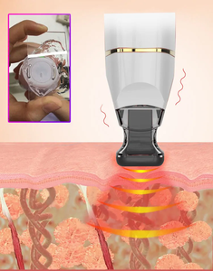 3-in-1 Schönheitsmaschine Hautpflege Anti-Aging Hautstraffung Gesichtsmassagegerät - Product Image 5