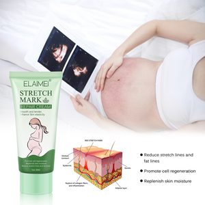 ELAIMEI Kem Trị Mụn Loại Bỏ Vết Rạn Da Vùng Bụng Loại Bỏ Vết Sẹo Khi Mang Thai - Product Image 5