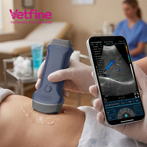 <span class=keywords><strong>Échographe</strong></span> Doppler Couleur <span class=keywords><strong>Portable</strong></span> Sans Fil et USB 3-en-1 à Bon <span class=keywords><strong>Prix</strong></span> - Product Image 2