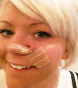 แผ่นปิดแผลแบบใช้ง่ายแผ่นสเตอริไอแบบมีกาวในตัวแบบใช้แล้วทิ้งใช้ง่ายรักษาแผลที่ผิวหนัง - Product Image 4