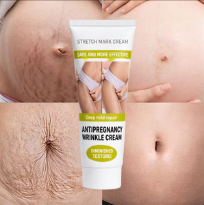 Crème réparatrice de cicatrices de <span class=keywords><strong>grossesse</strong></span> avec huile de coco et vitamine E, crème de massage raffermissante <span class=keywords><strong>pour</strong></span> <span class=keywords><strong>les</strong></span> cicatrices profondes d'acné post-partum et <span class=keywords><strong>les</strong></span> lignes de relâchement abdominales - Product Image 1