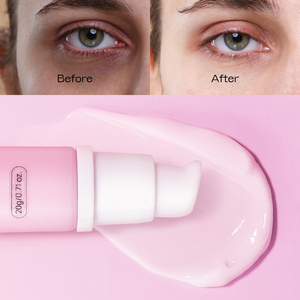 Cosmetici personalizzati per la cura della pelle con logo nero trattamento per gli occhi riducono il gonfiore degli occhi e il tenditore temporaneo naturale crema per gli occhi - Product Image 6