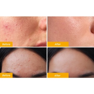 <span class=keywords><strong>Maschera</strong></span> <span class=keywords><strong>all</strong></span>'<span class=keywords><strong>Argilla</strong></span> di Curcuma OEM/ODM con Vitamina C per <span class=keywords><strong>Viso</strong></span> e Corpo, Tratta le Macchie Scure, Affina i Pori, Idrata e Nutre Tutti i Tipi di Pelle - Product Image 2