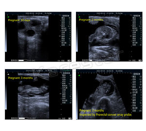 Penjualan langsung HARGA TERBAIK mesin <span class=keywords><strong>Ultrasound</strong></span> genggam sepenuhnya tahan air dokter hewan pemindai <span class=keywords><strong>Ultrasound</strong></span> portabel - Product Image 5