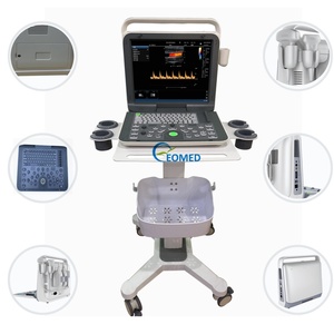 Appareils d'échographie médicale, échographe portable, système d'échographie Doppler couleur pour usage vétérinaire et humain CU60-1 - Product Image 2