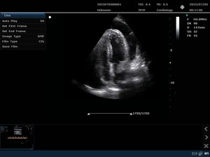 Échographe vétérinaire haute résolution SONOIMAGE N38 Crystal certifié CE Classe II prenant en charge le zoom d'image 10X en temps réel - Product Image 5