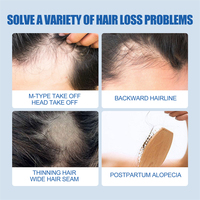 Solusi Perawatan Penumbuh Rambut East Moon Anti Rontok Serum Penumbuh Jenggot 60ml Minyak Jahe Untuk Pertumbuhan Rambut Pria