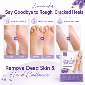 Hot Selling Gently Exfoliates Care Softens Rough Cracked Heels Hydrates Nourishes Lavender Niacinamide Exfoliating Foot Mask - Product Image 2