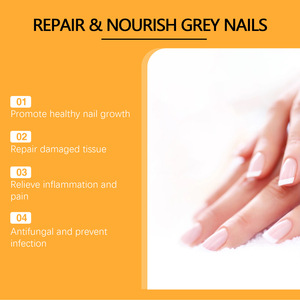 100 millilitres de spray pour les soins des ongles au venin d'abeille pour favoriser la croissance, réparer les tissus endommagés et soulager la douleur, lotion pour les ongles - Product Image 6