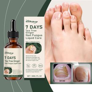 South Moon 30ML Solution Naturelle de Soin des Ongles à Base de Plantes, Spray Doux Anti-Fongique pour Ongles, Infusé à l'<span class=keywords><strong>Huile</strong></span> d'Arbre à Thé et au Gingembre - Product Image 3