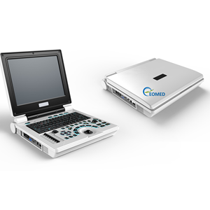 Harga pabrik Notebook sonografi pemindai Ultrasound Laptop hitam dan putih mesin Ultrasound dokter hewan BW30B - Product Image 3