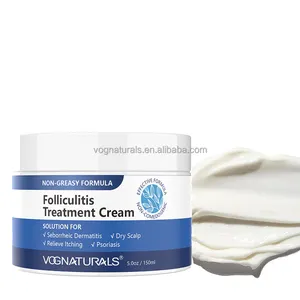 Creme de tratamento de folículolite de marca própria Aloe Vera Eczema hidratante tratamento de acne loção de alívio de folículolite e eczema