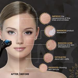 เครื่องกระตุ้นการเจริญเติบโตของเส้นขนบนใบหน้าสำหรับผู้ชาย ราคาประหยัดและคุณภาพดี  ลูกกลิ้งไมโครนีดเดิลขนาด 1 มม. สำหรับการเจริญเติบโตของเส้นผม รักษาสิวและหนวด - Product Image 2