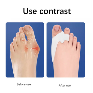 कारखाने प्रत्यक्ष सिलिकॉन जेल सेब्स हॉलगस पैर देखभाल रक्षक - Product Image 2