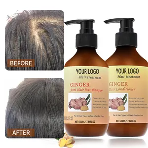 Шампунь для лечения выпадения волос, сглаживающий кондиционер, Органический натуральный рост волос, чистый шампунь для удаления перхоти, имбирный Шампунь OEM