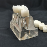 Modèle d'analyse dentaire 4 fois agrandi pour implants, couronnes, bridges, démonstration, modèle amovible, modèle d'enseignement et de formation pour dentistes
