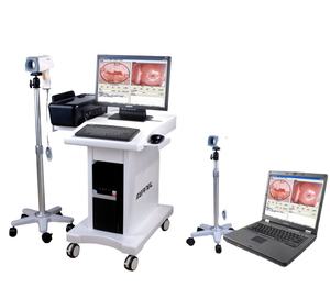 KN-2200 पोर्टेबल वायरलेस मिनी कैमरा चिकित्सा कोलोपोस्कोप के साथ प्लास्टिक सामग्री वर्ग i 1 वर्ष की वारंटी - Product Image 6