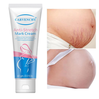 Crème réparatrice post-partum anti-vergetures et anti-ridules