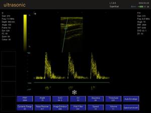 Ecógrafo Portátil para Mascotas, Perros y Gatos, KT-A028 - Product Image 4