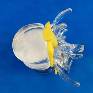 Anatomi Öğretimi için İntervertebral Disk Sıkıştırma Göstergeli Şeffaf İnsan Bel Omuru Modeli - Product Image 5