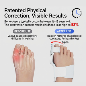 Correttore <span class=keywords><strong>per</strong></span> Hallux Valgus, Separatore <span class=keywords><strong>Dita</strong></span>, Dispositivo <span class=keywords><strong>per</strong></span> <span class=keywords><strong>Dita</strong></span> Divaricate, <span class=keywords><strong>Protezione</strong></span> in Silicone <span class=keywords><strong>per</strong></span> <span class=keywords><strong>Dita</strong></span> e Falangi <span class=keywords><strong>dei</strong></span> Bambini, Allevia il Dolore - Product Image 2