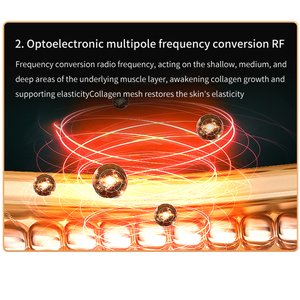 Chuyên nghiệp xách tay không dây sạc siêu âm Skin Scrubber điện Sonic Facial Exfoliator thiết bị cho mũi đầu làm sạch - Product Image 4