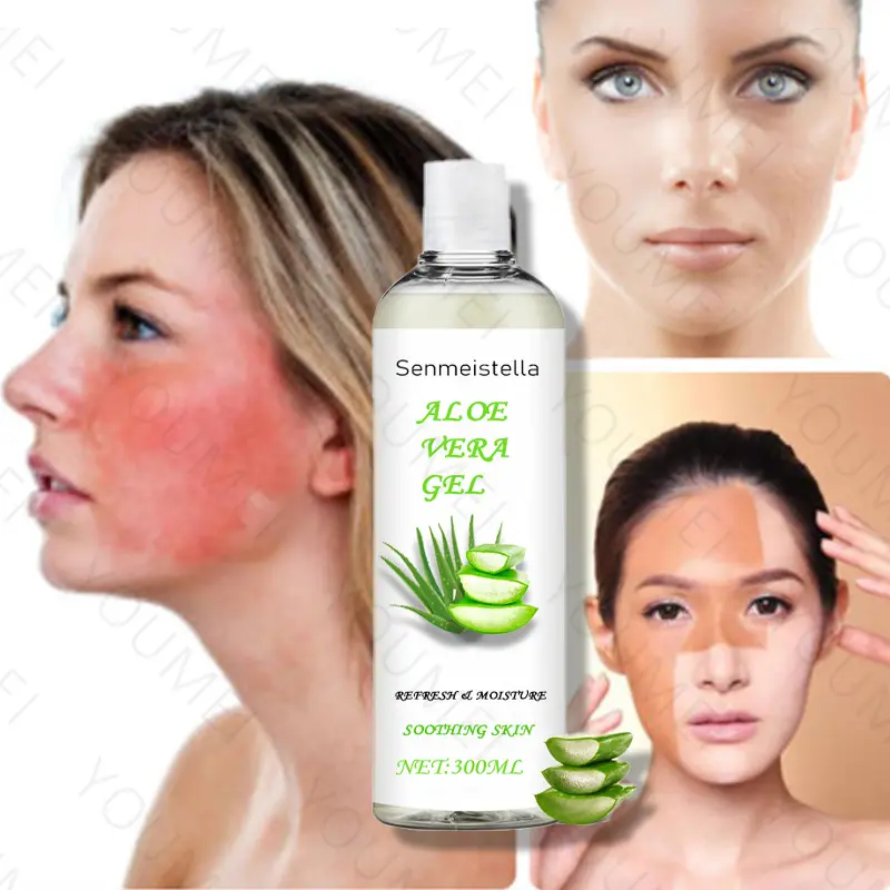 OEM 300ml trattamento della pelle Post Sun Repair Gel riparatore per l'acne Gel idratante rinfrescante all'aloe Vera naturale puro Gel crema viso corpo