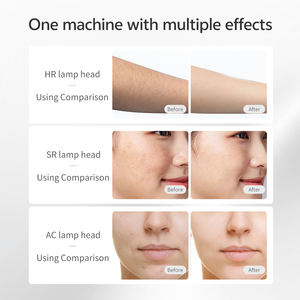 <span class=keywords><strong>Appareil</strong></span> d'<span class=keywords><strong>épilation</strong></span> au laser IPL Mlay Mini, utilisation à domicile sur tout le corps, traitement personnel des boutons, élimination des pigments, permanent, Royaume-Uni/États-Unis - Product Image 2