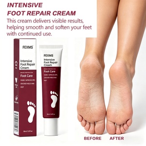 <span class=keywords><strong>Crème</strong></span> réparatrice intensive pour les pieds en gros pour éliminer les peaux mortes Non grasse Exfoliante en douceur Hydratante en profondeur pour restaurer la peau - Product Image 3