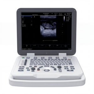 Escáner Veterinario SONOIMAGE D20 <span class=keywords><strong>Prestige</strong></span> con Estructura Adaptada para Viajes, Ofrece Imágenes Brillantes para una Clasificación Acelerada de Animales de Granja - Product Image 5