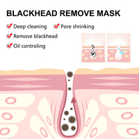 Masques faciaux pour éliminer les points noirs, points noirs, masques pour le nez, charbon de bambou, points noirs, boutons, anti-acné, soin de la peau du visage, outils de beauté