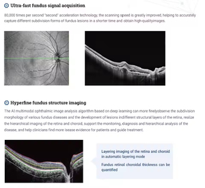 La máquina OCT de tomografía de coherencia óptica profesional médica de Oftalmología es imprescindible para los oftalmólogos - Product Image 6