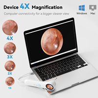 Endoscope ENT OEM/ODM avec écran HD de 1,28 pouce, caméra de 3,9 mm, otoscope pour l'inspection des oreilles, du nez et de la gorge, avec batterie rechargeable