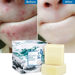 Jabón de leche de cabra hecho a mano para blanquear orgánico natural elimina el acné Limpieza facial profunda - Product Image 4