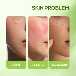 ไอซ์ซี ขายส่ง/รับผลิตแบรนด์ส่วนตัว เซรั่มทีทรีลดสิว 30 มล. - Product Image 2