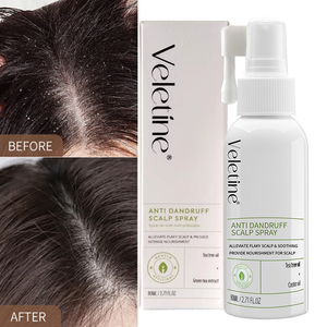 OEM/ODM Hair Silking Mist Cleansing Kopfhaut öl-Kontrolle Entfernen Sie Geruch Minze Anti Itchy Relief Kopfhaut Haar erfrischung <span class=keywords><strong>spray</strong></span> - Product Image 1