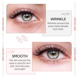Masque pour les yeux au collagène blanchissant, <span class=keywords><strong>prix</strong></span> d'usine, vente chaude, personnalisation, élimine les poches sous les yeux et les <span class=keywords><strong>cernes</strong></span> - Product Image 5