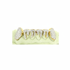 Joyería Dental de Lujo Personalizada para Regalo de Compromiso, Grillz de Plata de Ley 925 con Diamantes de Moissanita y Polvo de Diamante - Product Image 1