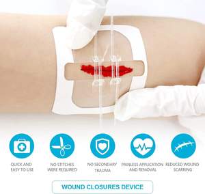Perangkat penutup luka kulit dasi ritsleting medis sekali pakai untuk strip darurat perangkat penutup luka - Product Image 3