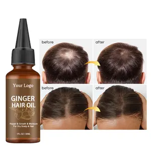 Private Label Anti Loss Serum Hair Growth Oil Alopecia Hair Loss Treatment Products Organic Herbal Ginger Regrowth Oil