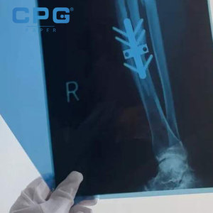 Película PET Antivaho de Suministro Directo para Visibilidad Clara, Película BOPET de 12 micras para Envasado de Alimentos Frescos, Película para Exhibición de Productos - Product Image 6