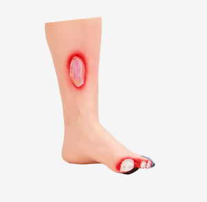 Modello didattico del piede diabetico, Modello del piede per infermieristica, Modello patologico - Product Image 6