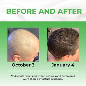 Private Label Organico Naturale Dei Capelli Fatti A Mano di Riparazione Elixir Trattamento Del Cuoio Capelluto Gallone Crescita Dei Capelli Olio - Product Image 6