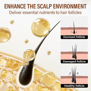 น้ำมันปลูก<span class=keywords><strong>ผม</strong></span>สมุนไพรพร้อมสารสกัดจากหลายก้อนสารสกัดป้อ<span class=keywords><strong>ง</strong></span>กันการหลุดร่วงขอ<span class=keywords><strong>ง</strong></span>เส้น<span class=keywords><strong>ผม</strong></span>รั<span class=keywords><strong>ง</strong></span>แคสำหรับการรักษา<span class=keywords><strong>ผม</strong></span><span class=keywords><strong>เสีย</strong></span> - Product Image 6